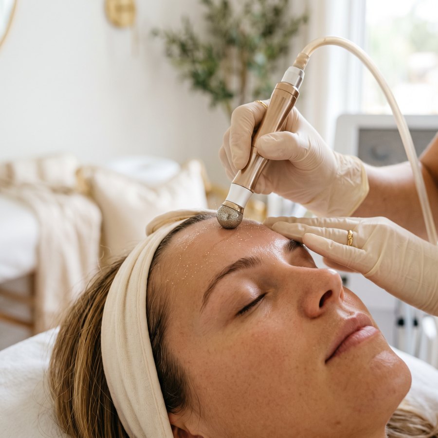 Microdermabrasion bei Höfler Finest